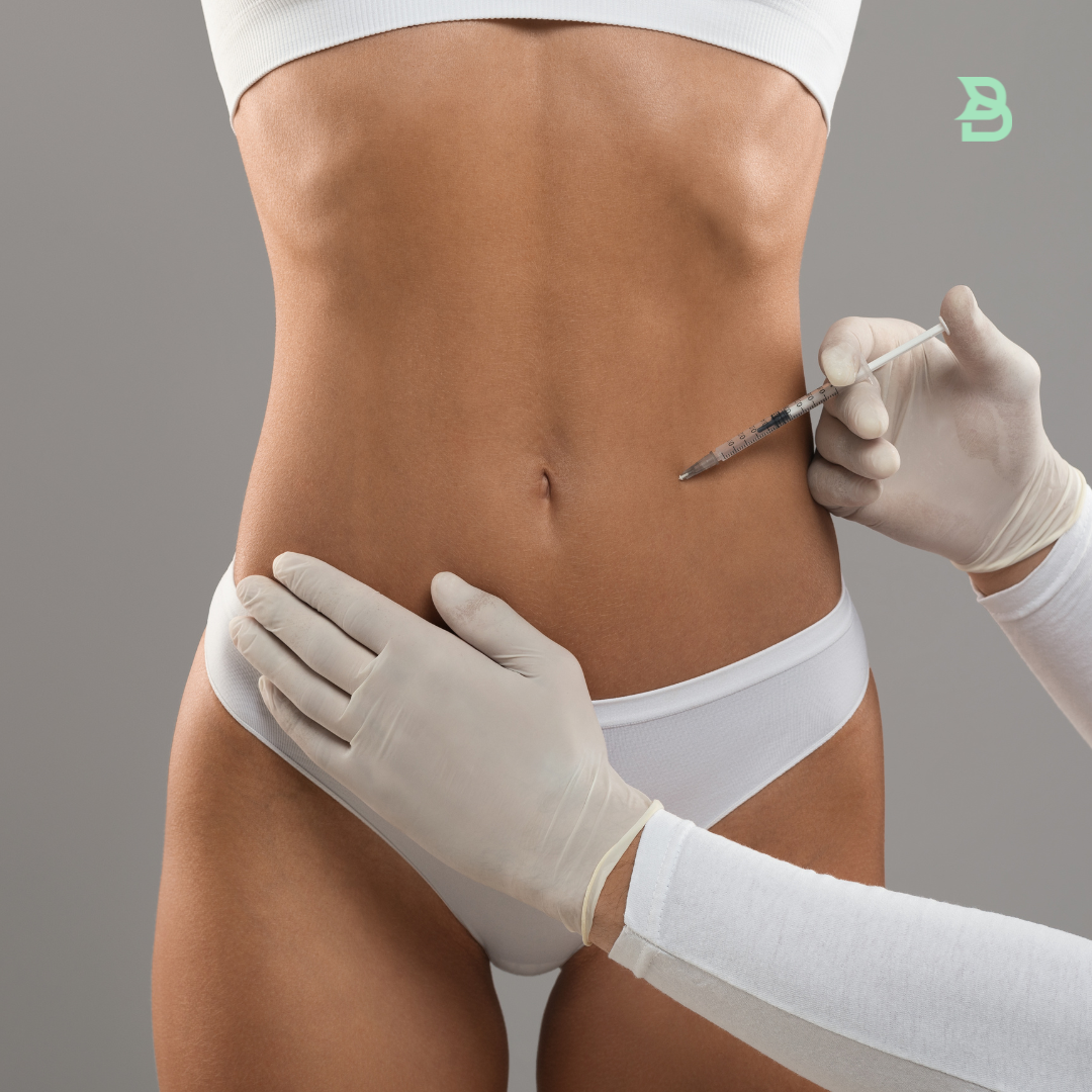Mesoterapia (Ampolleta reductiva)