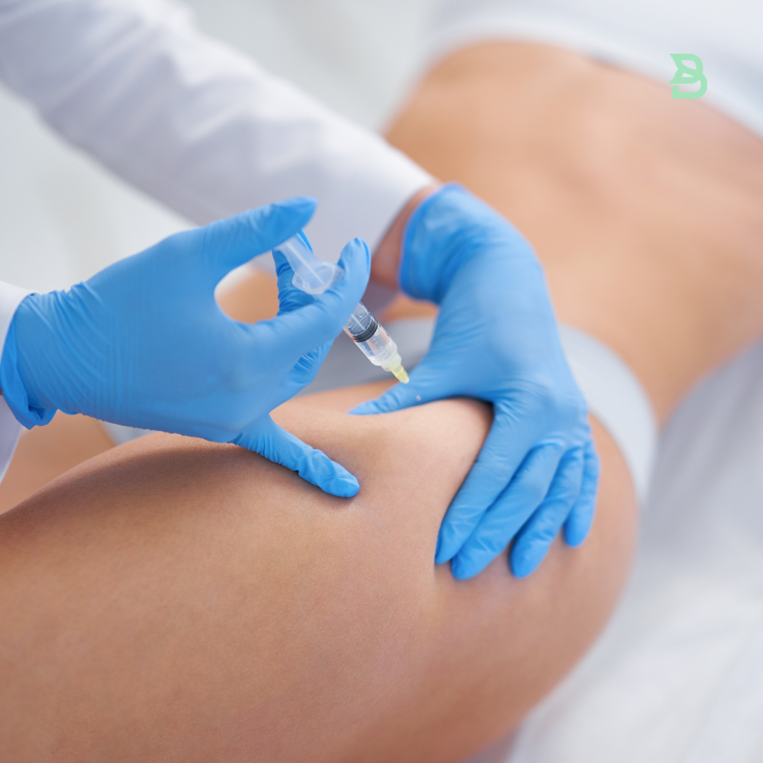 Mesoterapia (Ampolleta anticelulitis)