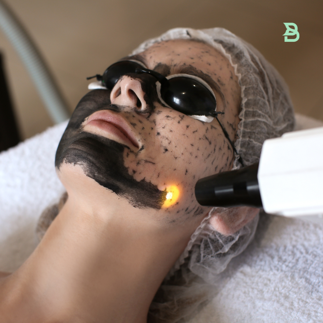 Hollywood peeling